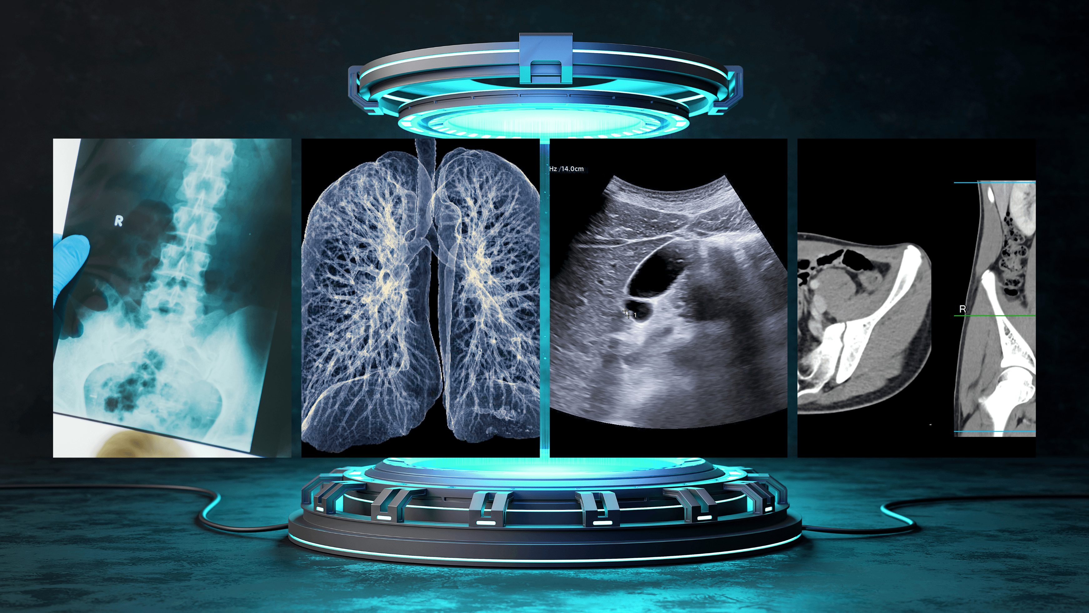 Contraste nos Exames de Imagem: Tipos, Indicações e Cuidados